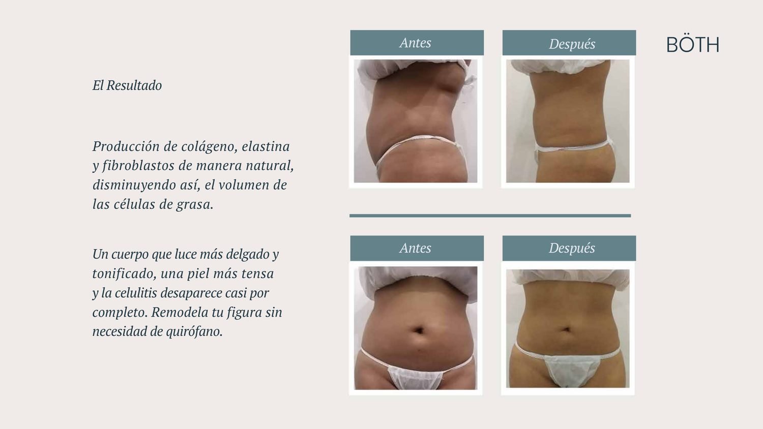 Antes y después corporal