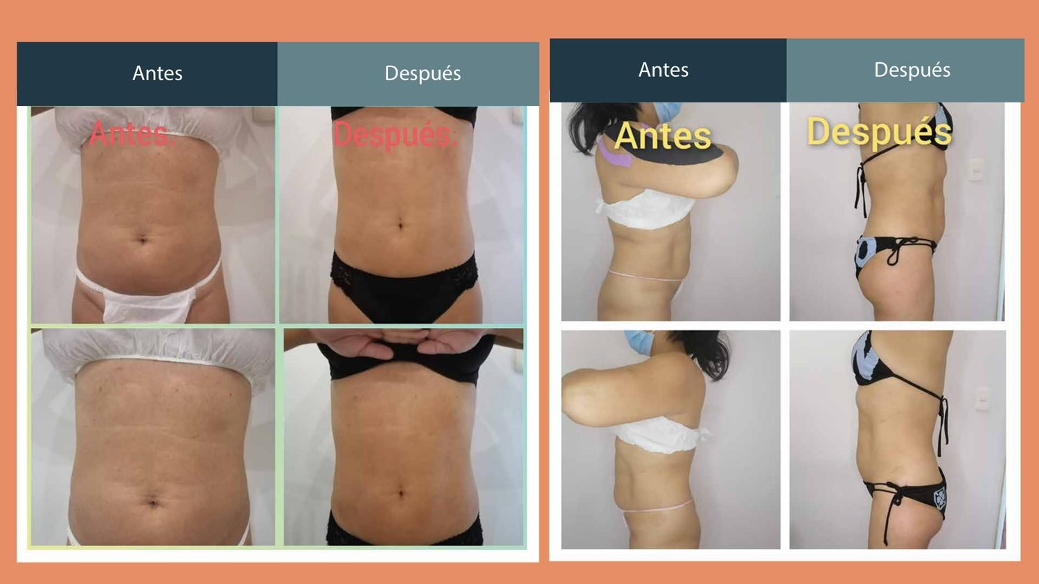 Antes y después corporal