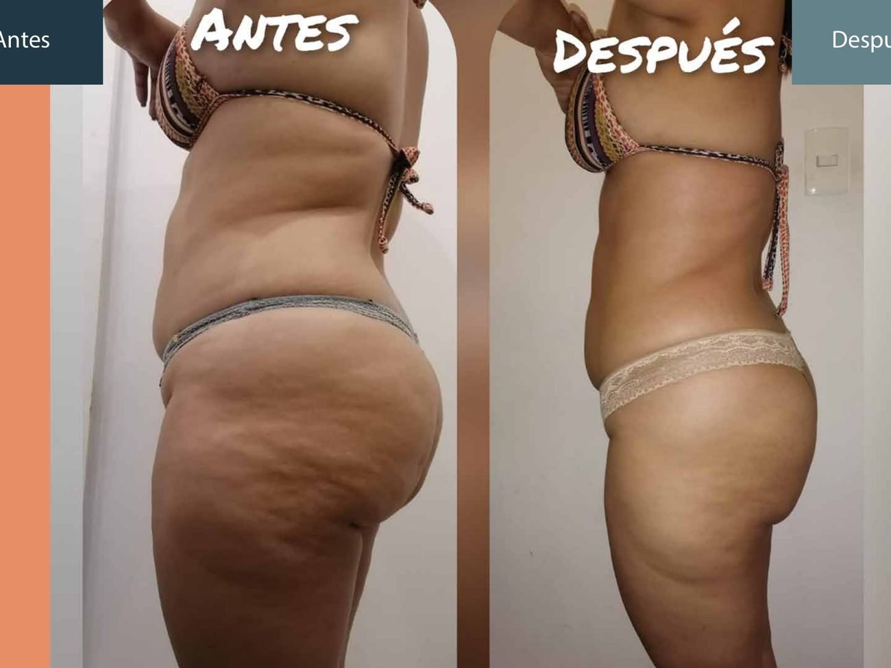 Antes y después silueta