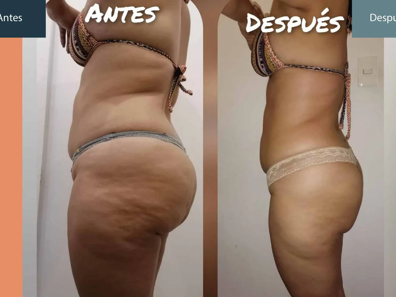 Antes y después silueta